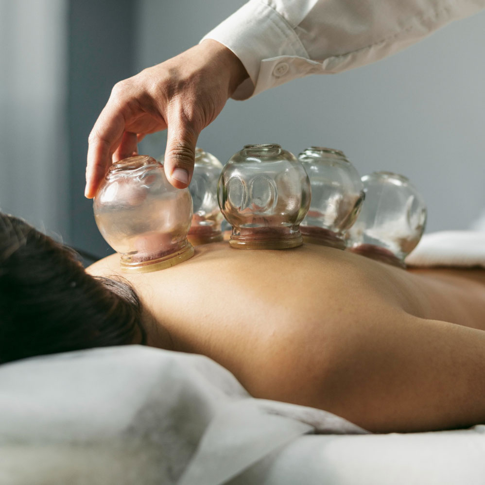Cupping for Myofascial Release Therapy
